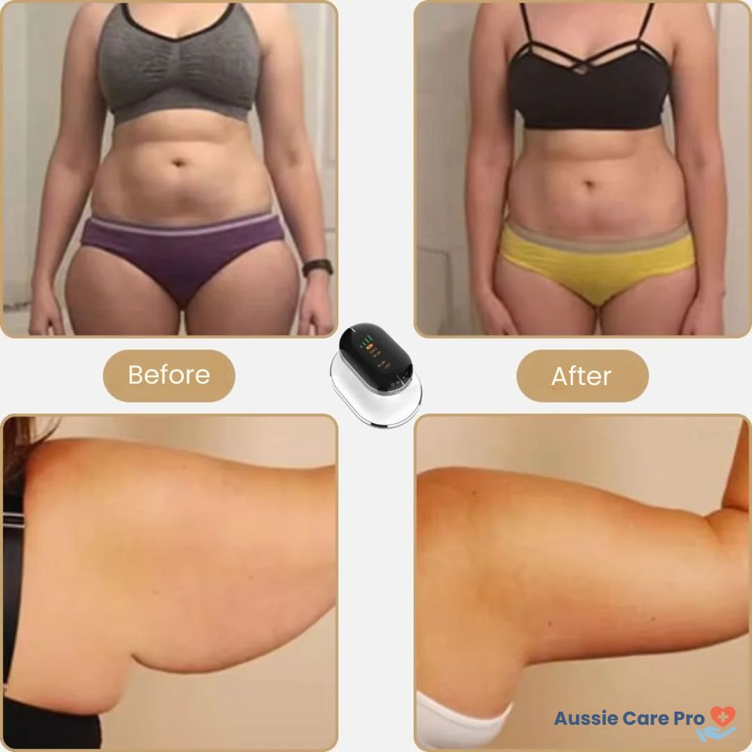 4-in-1 Body Sculpting & Cellulite Massager – Slimming, Skin Tightening & Toning Device