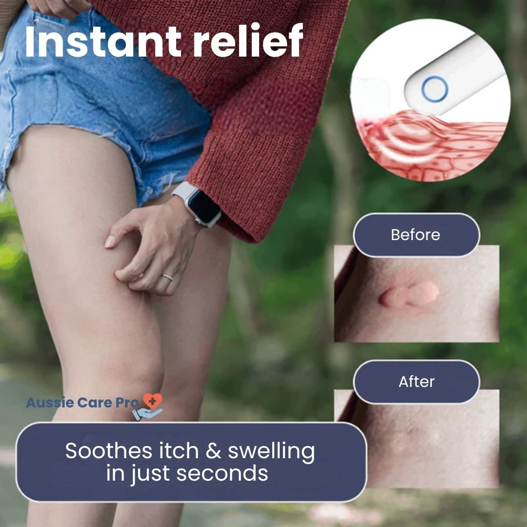 Electronic Anti-Itch Pen – Fast Relief from Mosquito Bites