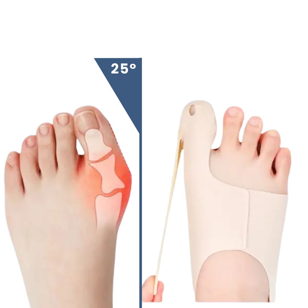Aussie Care Pro – Hallux Corrector for Pain-Free Movement