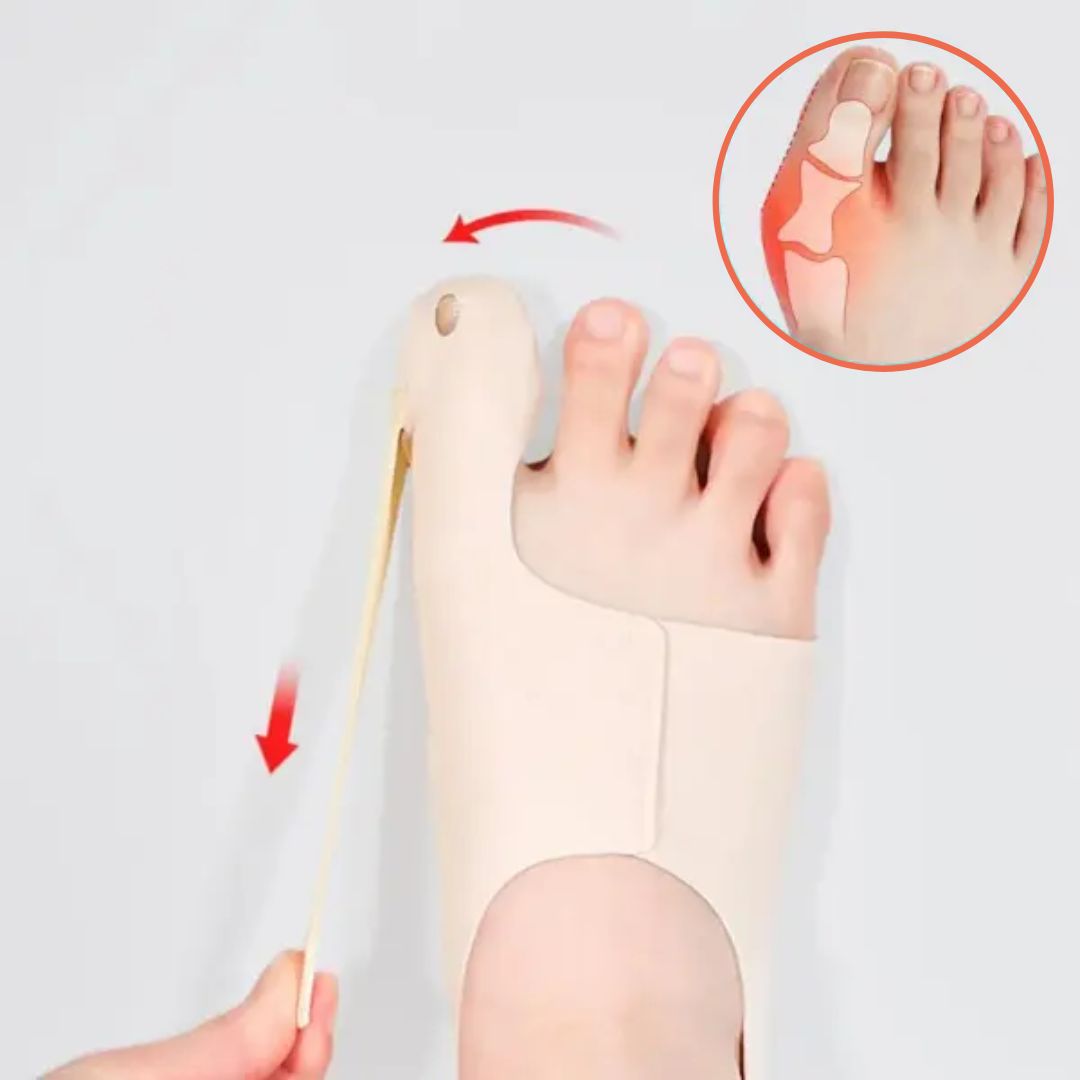 Aussie Care Pro – Hallux Corrector for Pain-Free Movement