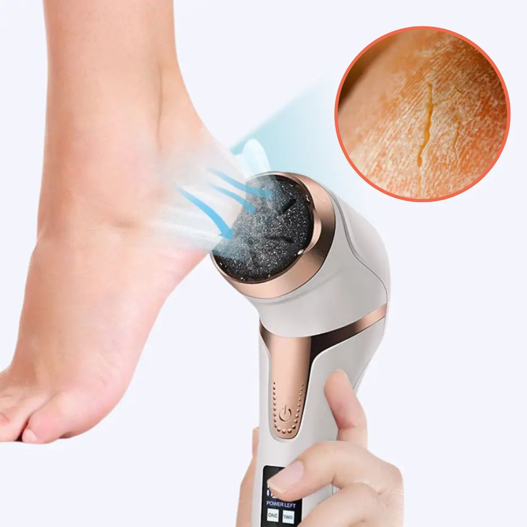 Aussie Care Pro Electric Callus Remover