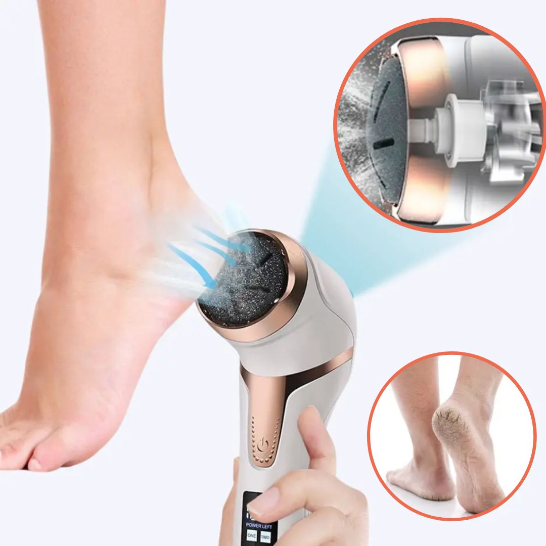 Aussie Care Pro Electric Callus Remover