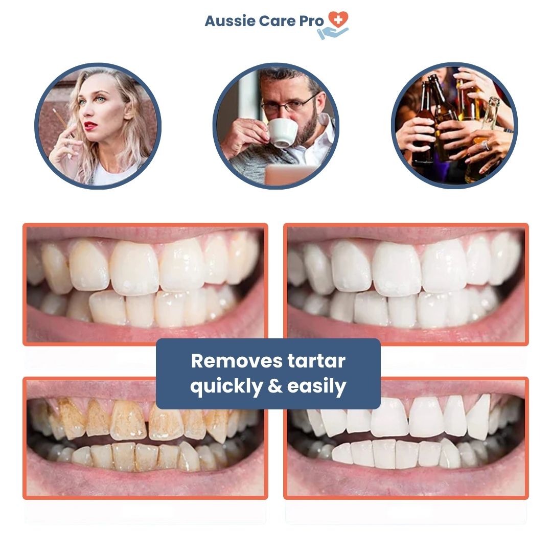 Ultrasonic Plaque & Tartar Remover – Professional Dental Cleaner for a Bright, Healthy Smile