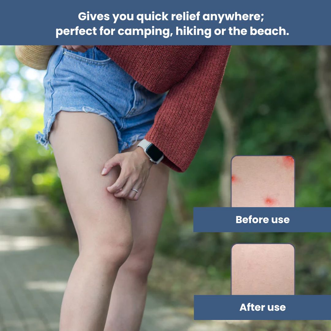 ThermoRelief – Instant Relief for Insect Bites
