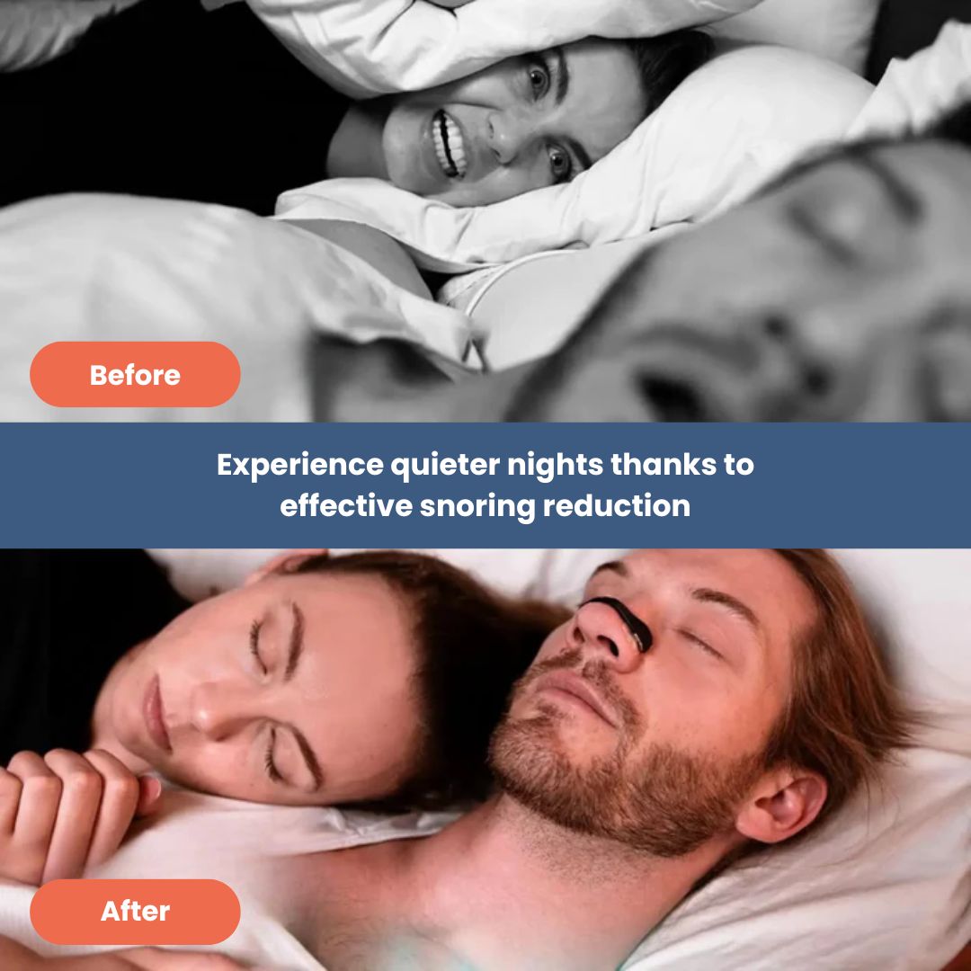 NasalFlow Pro – Advanced Nasal Breathing Aid for Better Sleep & Performance