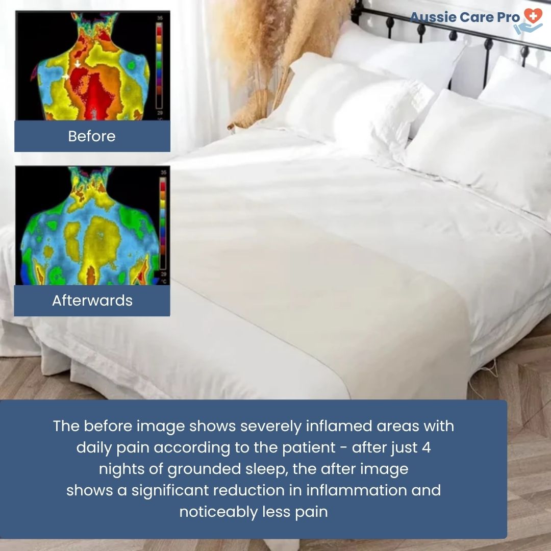 SilverGround Grounding Bed Sheet – Natural Sleep & Inflammation Relief