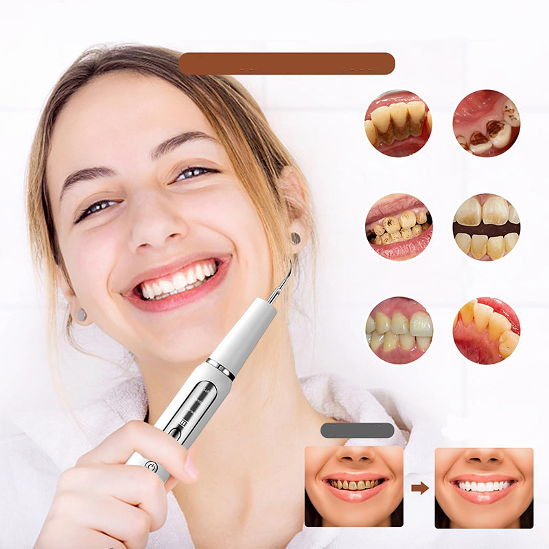 Ultrasonic Dental Plaque Remover – Rechargeable & Professional Teeth Cleaning
