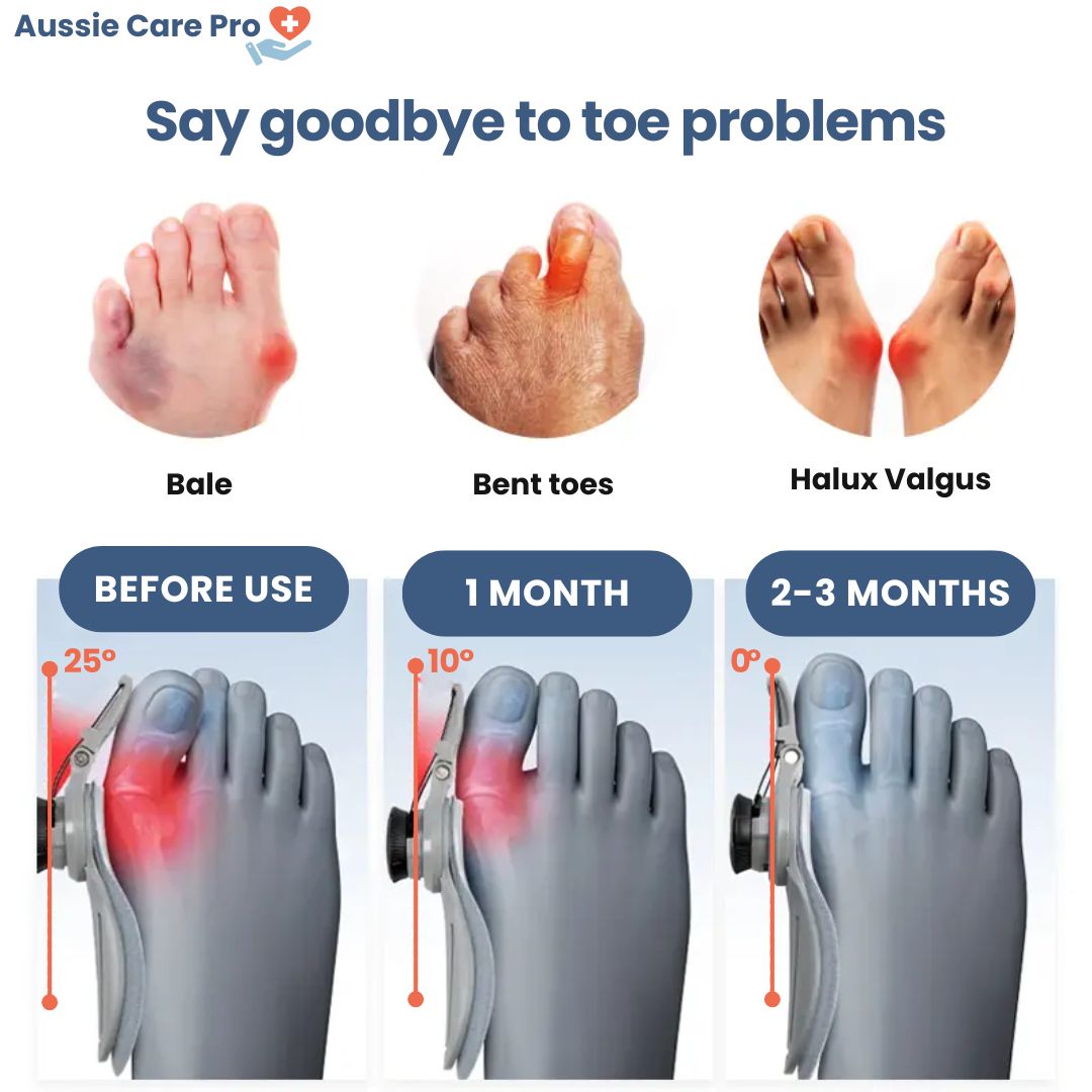 Aussie Care Pro – Hallux Corrector Brace