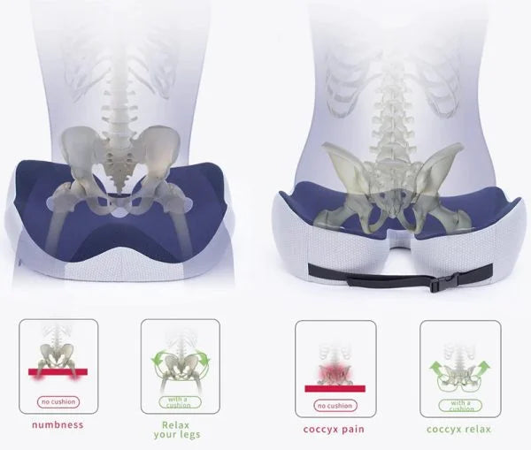 coccyx cushion/age uk pressure cushions/donut cushions/donut seat cushion/doughnut cushion/driving cushion/orthopedic cushion for sciatica/piles cushion/wheelchair comfort seat/coccy cushion/coccyx cushion for office chair/sciatica seat cushion for car/Pressure Relief Ergonomic & Orthopedic Seat Cushion, for Lower Back, Tailbone, Hip, Hamstrings, Sciatica Pain