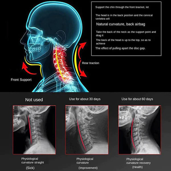 Cervical Collar Brace for Neck