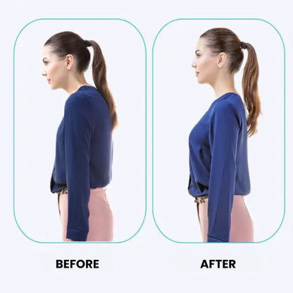 Smart Posture Corrector – Intelligent Back Support for Better Posture & Pain Relief