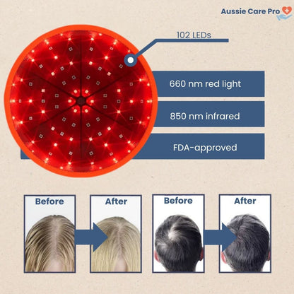 RevitaCap Light Therapy Hair Cap – FDA-Cleared 660 nm & 850 nm for Fuller, Stronger Hair