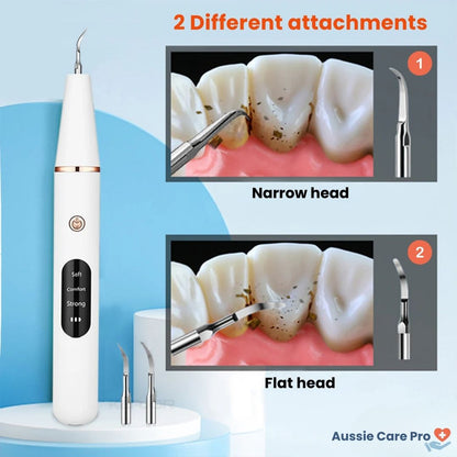 Ultrasonic Plaque & Tartar Remover – Professional Dental Cleaner for a Bright, Healthy Smile