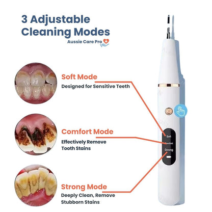 Ultrasonic Plaque & Tartar Remover – Professional Dental Cleaner for a Bright, Healthy Smile