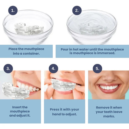 SilentGuard™ – Anti-Snoring & Teeth Grinding Mouthpiece