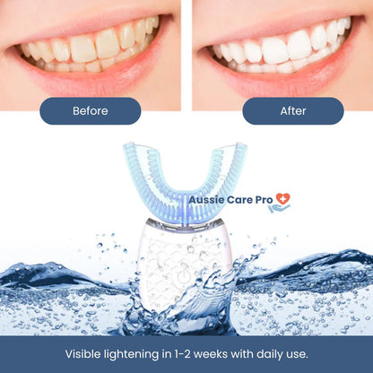 Automatic U-Shaped Toothbrush – Hands-Free Electric Cleaner