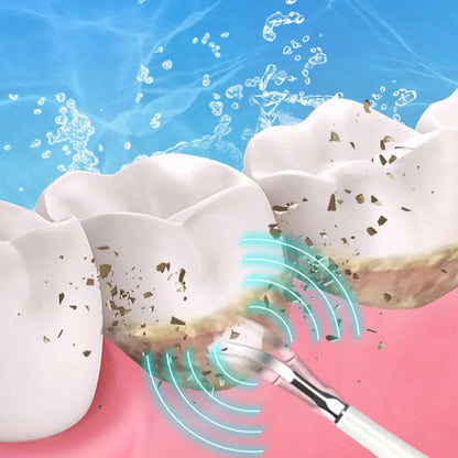 SparkSonic – Sonic Dental Cleaner & Whitening Irrigator